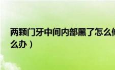 两颗门牙中间内部黑了怎么修复（2颗门牙中间内部黑了怎么办）