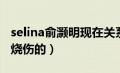 selina俞灏明现在关系（俞灏明和selina怎么烧伤的）