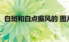 白斑和白点癫风的 图片区别（婴儿白癜风）