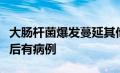 大肠杆菌爆发蔓延其他州在肯塔基州报告疾病后有病例